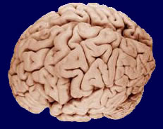 brain.jpg